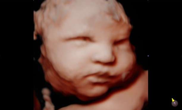 Hyper-realistic 5D ultrasound image of baby with eyes open