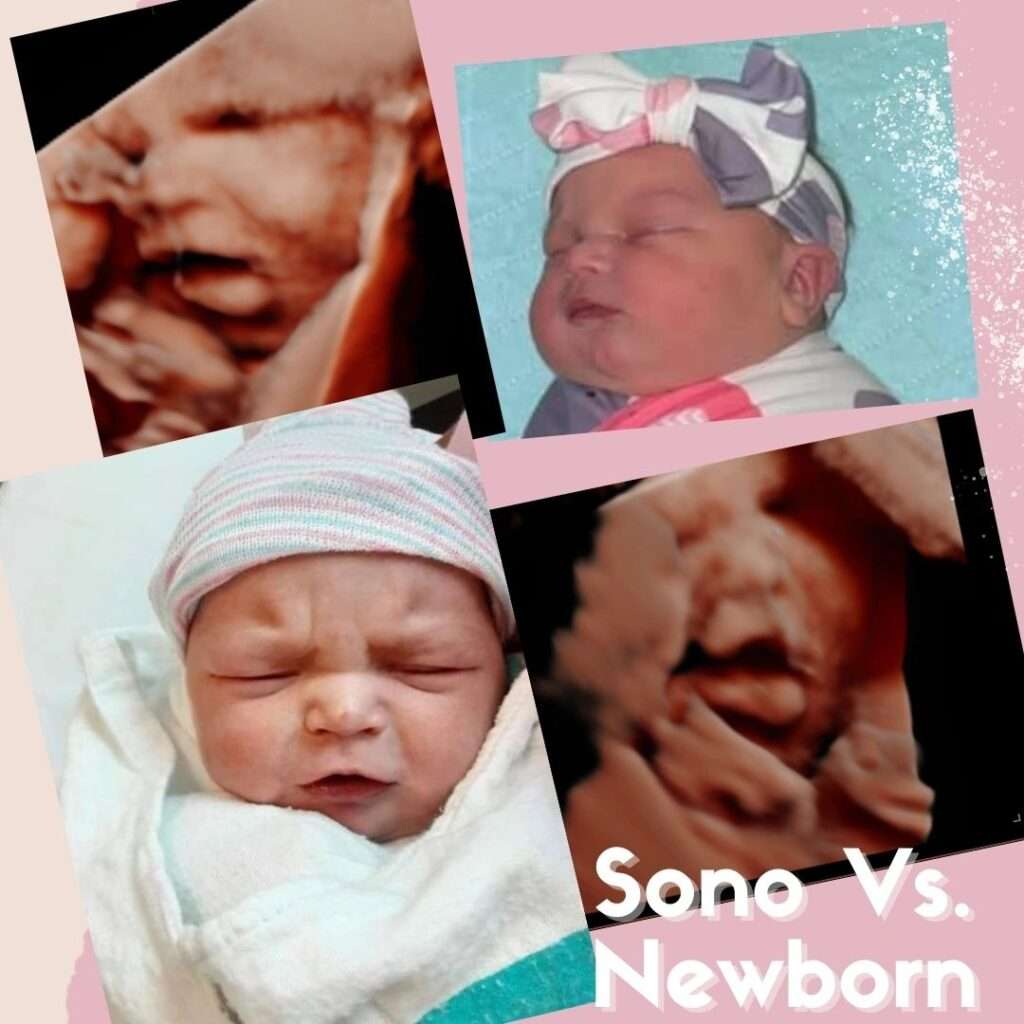Newborn photos compared to ultrasound photos