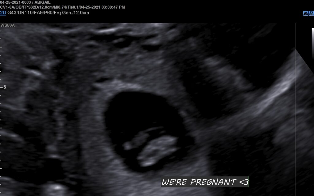 Early 1st Trimester 2D Ultrasound