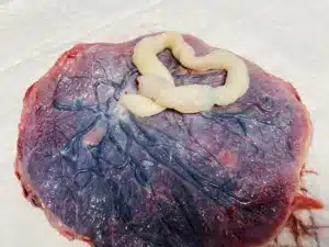 Placenta & Heart Umbilical Cord