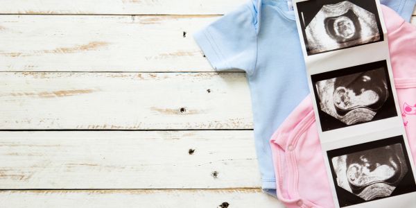 Gender reveal ultrasound service at Peeping Moms Ultrasound Boutique