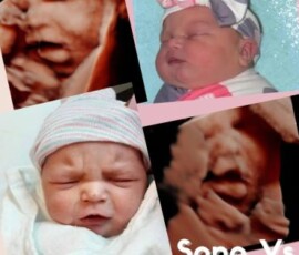 See how your baby’s 3D ultrasound features match their newborn photo. Side-by-side comparison of newborn baby and 3D ultrasound image showing facial similarities