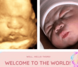 Real ultrasound and newborn photos shared by happy families from Peeping Moms Ultrasound Boutique. Peeping Moms Ultrasound photo gallery showing 3D, 5D, and 8K baby ultrasound images and newborn photos