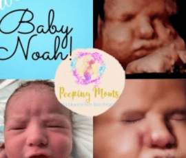 Real ultrasound and newborn photos shared by happy families from Peeping Moms Ultrasound Boutique. Peeping Moms Ultrasound photo gallery showing 3D, 5D, and 8K baby ultrasound images and newborn photos