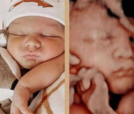 Real ultrasound and newborn photos shared by happy families from Peeping Moms Ultrasound Boutique. Peeping Moms Ultrasound photo gallery showing 3D, 5D, and 8K baby ultrasound images and newborn photos