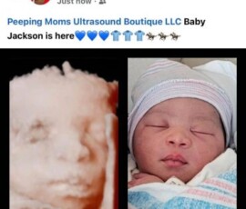 Real ultrasound and newborn photos shared by happy families from Peeping Moms Ultrasound Boutique. Peeping Moms Ultrasound photo gallery showing 3D, 5D, and 8K baby ultrasound images and newborn photos