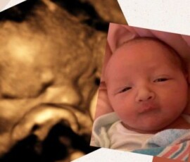 Real ultrasound and newborn photos shared by happy families from Peeping Moms Ultrasound Boutique. Peeping Moms Ultrasound photo gallery showing 3D, 5D, and 8K baby ultrasound images and newborn photos