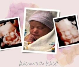 Real ultrasound and newborn photos shared by happy families from Peeping Moms Ultrasound Boutique. Peeping Moms Ultrasound photo gallery showing 3D, 5D, and 8K baby ultrasound images and newborn photos