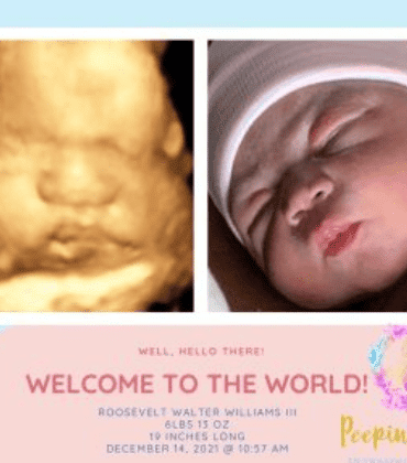 3D ultrasound compared to Newborn photo