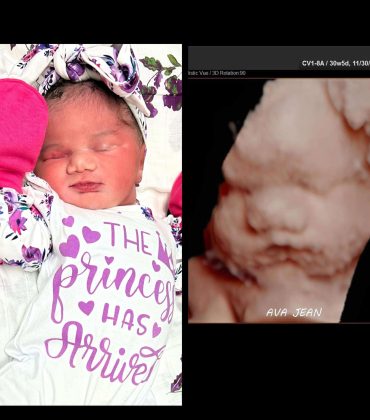 Newborn photo and 5D ultrasound photo