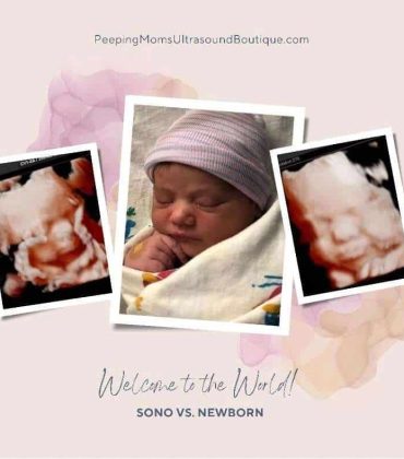 5D ultrasounds and newborn photo